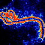 Tot ce trebuie să ştii despre virusul Ebola