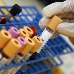 Studiu: Un nou test sanguin pentru depistarea pacienților cu risc foarte scăzut de infarct