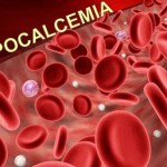 Hipocalcemia – cauze, simptome, tratament