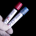 Testul HIV: când să-l faci şi ce implică