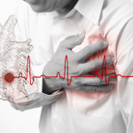 Cum să supraviețuiești unui infarct dacă ești singur