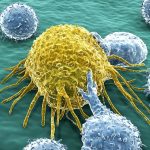Cancerul: cum apare, factori care îl declanşează şi cum se răspândeşte