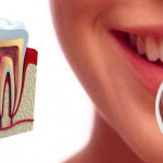 Lucruri pe care nu le ştiai despre implantul dentar