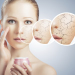 Ce boli ar putea ascunde pielea foarte uscată