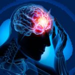 Epilepsia: diagnostic, simptome, tratament